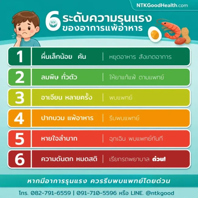 6 ระดับอาการแพ้อาหาร