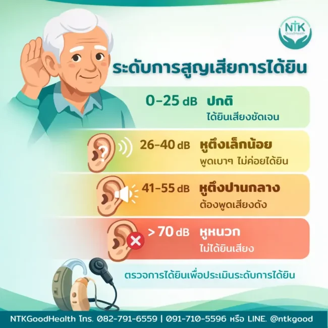 ระดับการสูญเสียการได้ยิน