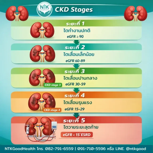 ระยะของโรคไตเรื้อรัง